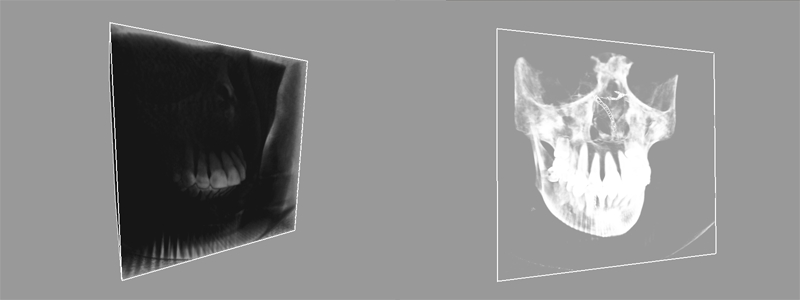 ../../../_images/wf_VolumeView_04.jpg